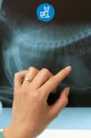 Thumbnail para Raio X